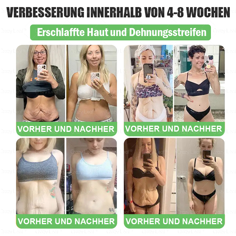🔥👨⚕️Klinisch bestätigt | Offizieller Shop CrazyLeaf® GLP-1 Trinklösung – wirkt gezielt gegen hartnäckiges Gewicht, Bluthochdruck, Blutzucker, Fettleber, Gelenkschmerzen, Müdigkeit & schlaffe Haut – für mehr Gesundheit & Energie.