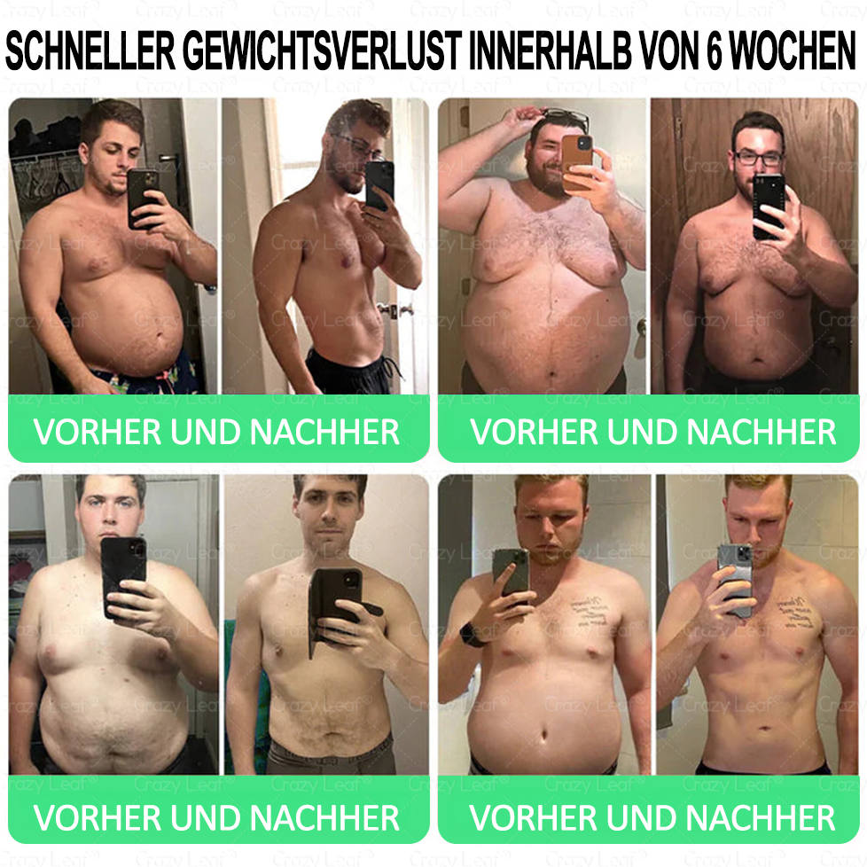 🔥👨⚕️Klinisch bestätigt | Offizieller Shop CrazyLeaf® GLP-1 Trinklösung – wirkt gezielt gegen hartnäckiges Gewicht, Bluthochdruck, Blutzucker, Fettleber, Gelenkschmerzen, Müdigkeit & schlaffe Haut – für mehr Gesundheit & Energie.