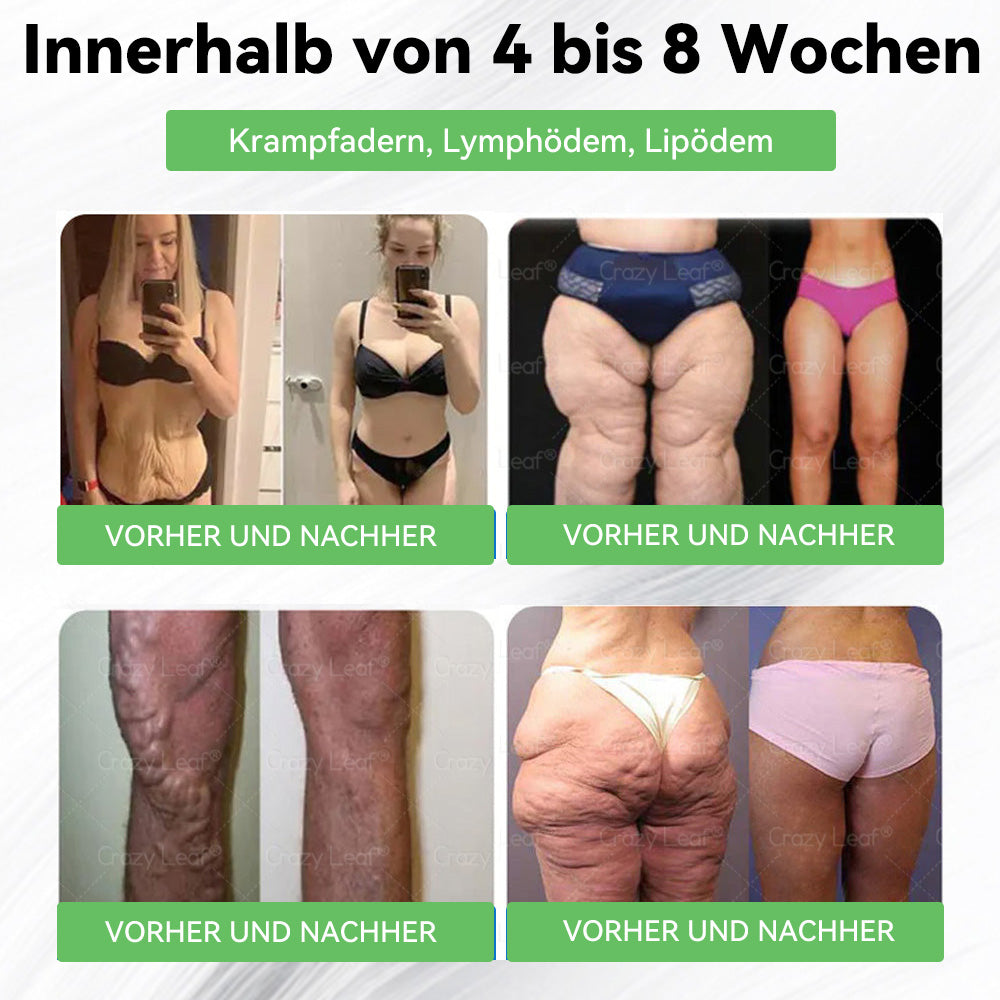 🔥👨⚕️Klinisch bestätigt | Offizieller Shop CrazyLeaf® GLP-1 Trinklösung – wirkt gezielt gegen hartnäckiges Gewicht, Bluthochdruck, Blutzucker, Fettleber, Gelenkschmerzen, Müdigkeit & schlaffe Haut – für mehr Gesundheit & Energie.