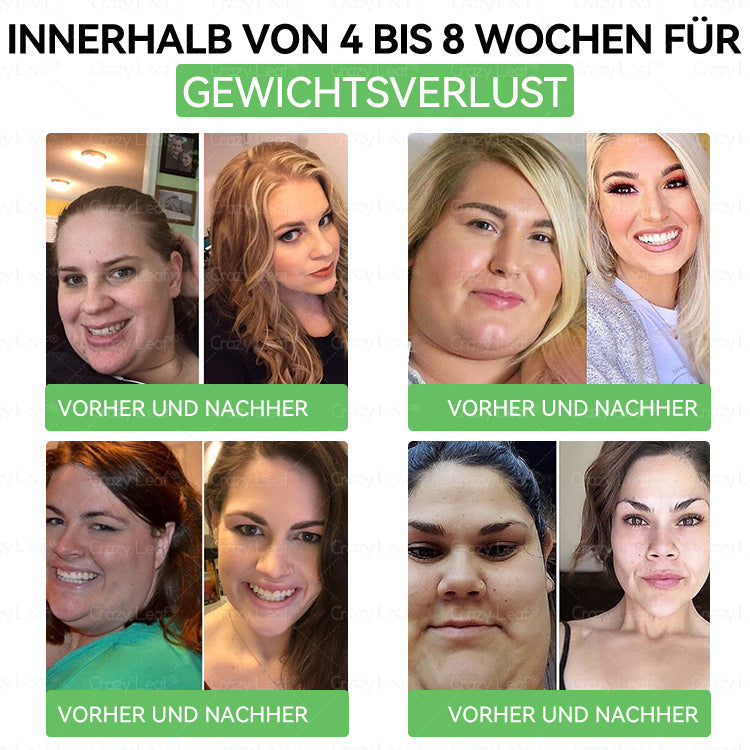 🔥👨⚕️Klinisch bestätigt | Offizieller Shop CrazyLeaf® GLP-1 Trinklösung – wirkt gezielt gegen hartnäckiges Gewicht, Bluthochdruck, Blutzucker, Fettleber, Gelenkschmerzen, Müdigkeit & schlaffe Haut – für mehr Gesundheit & Energie.