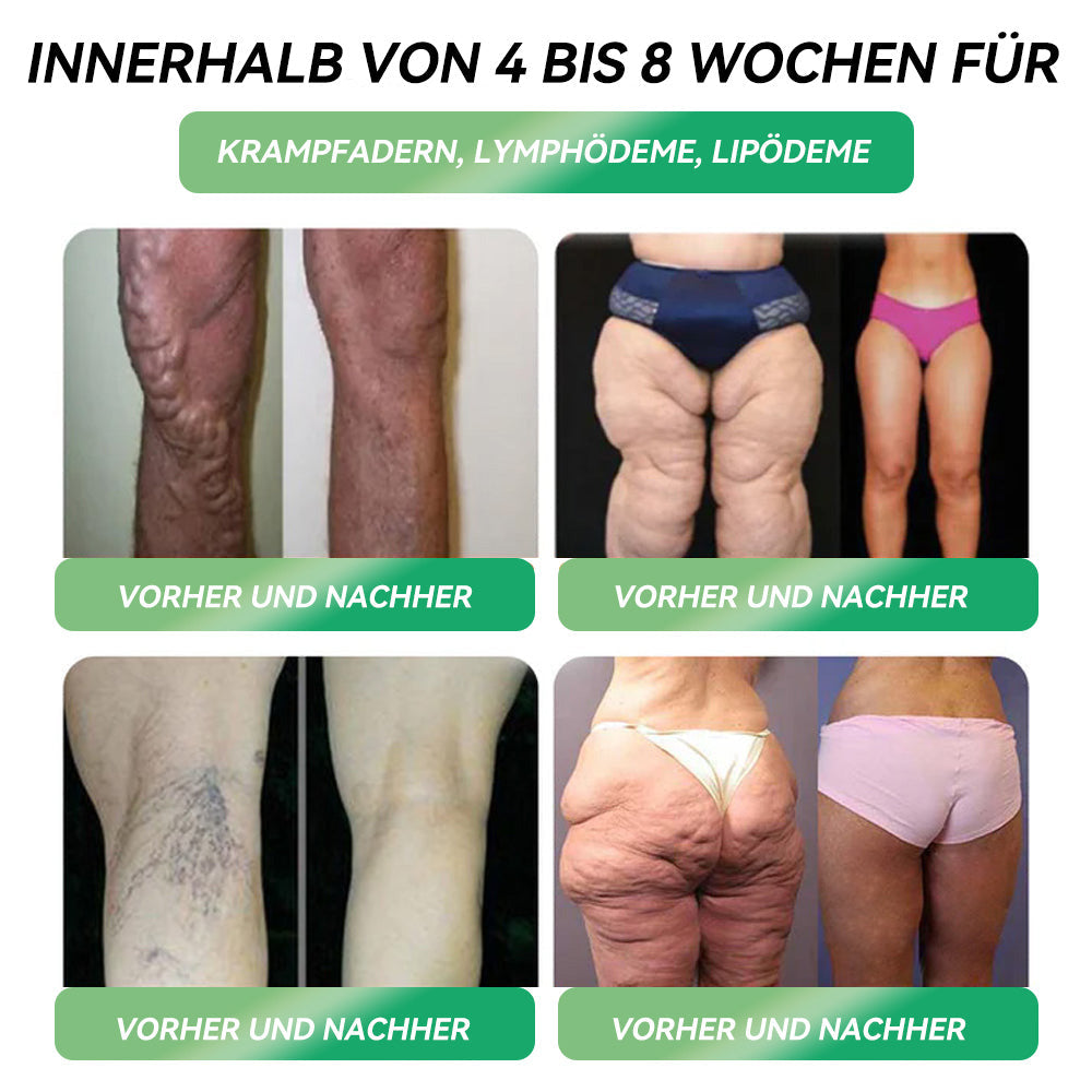⏰ Herzlichen Glückwunsch! Du hast ein exklusives CrazyLeaf®-Angebot freigeschaltet! Als Dankeschön für deine Bestellung bieten wir dir heute zusätzlich 30% Rabatt! Klicke unten, um dieses Sonderangebot zu sichern, es läuft bald ab! ⏰