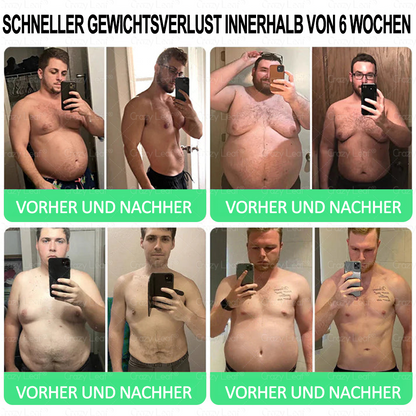 🔥👨‍⚕️Klinisch bestätigt | Offizieller Shop CrazyLeaf® GLP-1 Trinklösung – wirkt gezielt gegen hartnäckiges Gewicht, Bluthochdruck, Blutzucker, Fettleber, Gelenkschmerzen, Müdigkeit & schlaffe Haut – für mehr Gesundheit & Energie.
