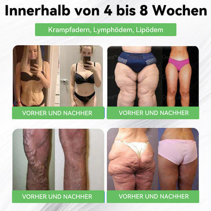 🔥👨‍⚕️Klinisch bestätigt | Offizieller Shop CrazyLeaf® GLP-1 Trinklösung – wirkt gezielt gegen hartnäckiges Gewicht, Bluthochdruck, Blutzucker, Fettleber, Gelenkschmerzen, Müdigkeit & schlaffe Haut – für mehr Gesundheit & Energie.